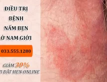 Nấm bẹn ở nam: Nguyên nhân, Triệu chứng & Cách điều trị hiệu quả