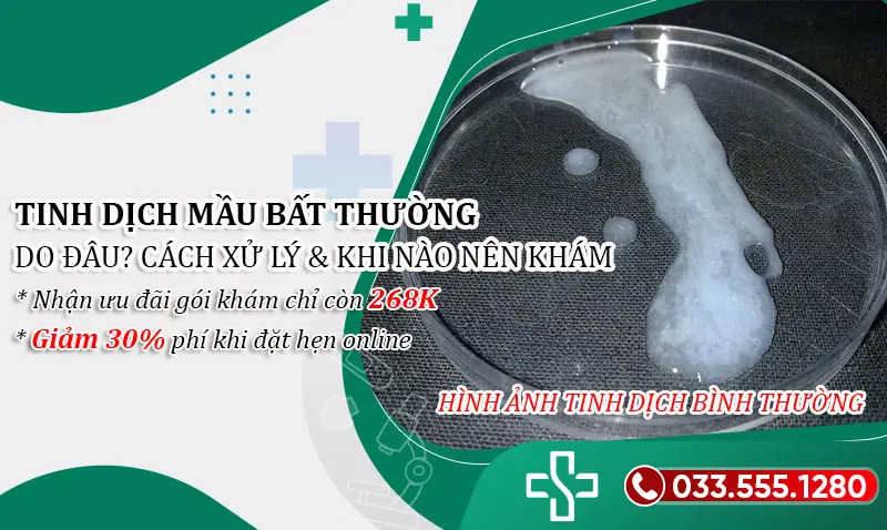 Tinh dịch có màu bất thường do đâu? Cách xử lý & Khi nào cần chăm sóc y tế