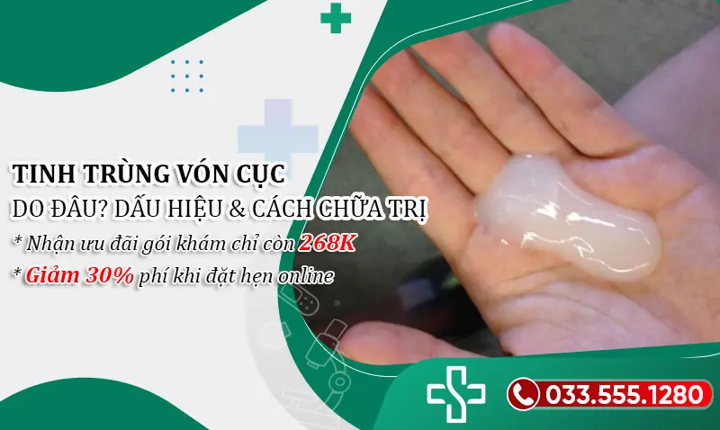 Tinh trùng bị vón cục là như thế nào?