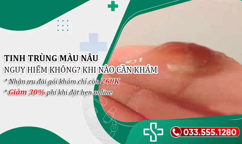 Tinh trùng màu nâu có sao không? Hiểu rõ tránh rủi ro đáng tiếc!