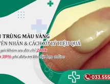 Tinh trùng màu vàng là sao? Nguyên nhân, cách xử lý hiệu quả