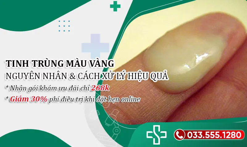 Tinh trùng màu vàng là sao? Nguyên nhân, cách xử lý hiệu quả