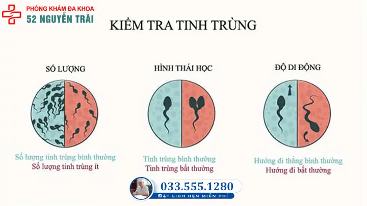 Đánh giá tinh trùng qua hình dạng, số lượng và chiều di động