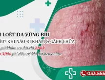 Viêm loét da bìu: Nguyên nhân & Cách điều trị tận gốc