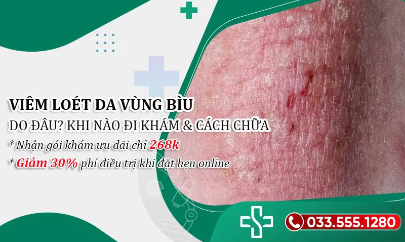 Viêm loét da bìu: Nguyên nhân & Cách điều trị tận gốc