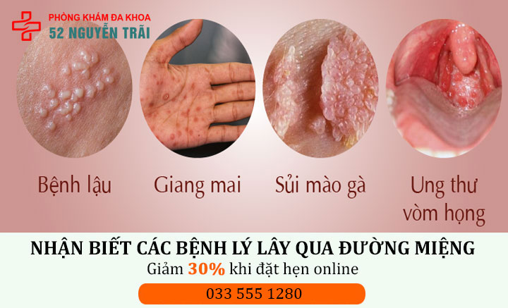 Các bệnh thường gặp khi quan hệ bằng miệng