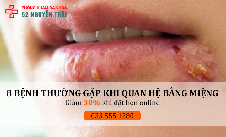 8 Bệnh thường gặp khi quan hệ bằng miệng