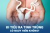 Tiểu ra tinh trùng là bệnh gì?