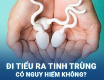 Tiểu ra tinh trùng là bệnh gì?