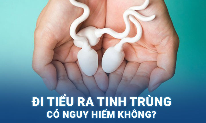 Tiểu ra tinh trùng là dấu hiệu của bệnh gì?