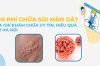 Bệnh viện chữa sùi mào gà ở đâu tốt nhất Hà Nội?