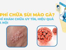 Bệnh viện chữa sùi mào gà ở đâu tốt nhất Hà Nội?