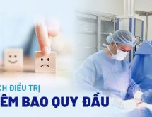 7 Mẹo chữa viêm bao quy đầu tại nhà bằng phương pháp dân gian