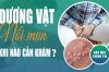 Hình ảnh dương vật mọc mụn đỏ là bệnh gì?