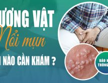 Hình ảnh dương vật mọc mụn đỏ là bệnh gì?