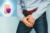 Dương vật bị thâm tím dấu hiệu 10 bệnh lý sau đây