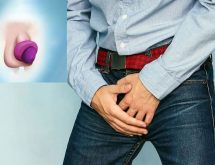 Dương vật bị thâm tím dấu hiệu 10 bệnh lý sau đây