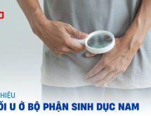 Khối u ở bộ phận sinh dục nam: Nguyên nhân, dấu hiệu, chẩn đoán và cách điều trị