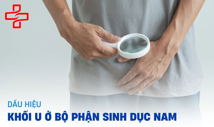Khối u ở bộ phận sinh dục nam: Nguyên nhân, dấu hiệu, chẩn đoán và cách điều trị
