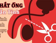 Hình ảnh trước và sau khi thắt ống dẫn tinh