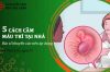 Cách cầm máu trĩ tại nhà an toàn – Bạn đã biết chưa?