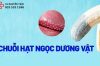 Cách chữa chuỗi hạt ngọc dương vật tại nhà