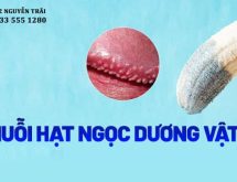 Cách chữa chuỗi hạt ngọc dương vật tại nhà
