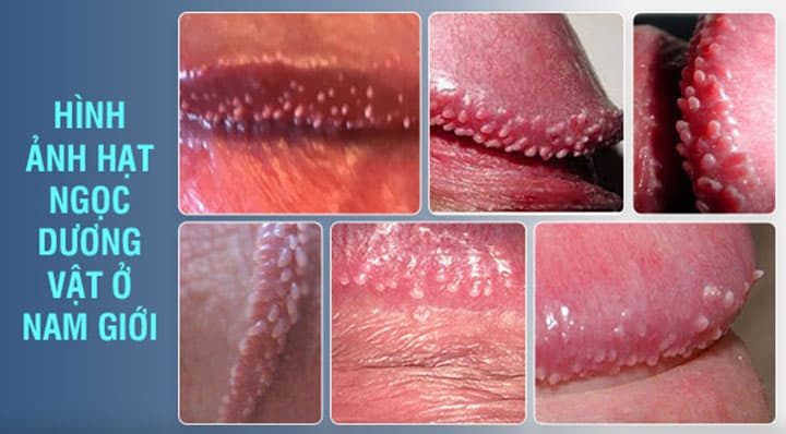 Chuỗi hạt ngọc dương vật là gì?