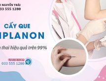 Cấy que tránh thai: Phương pháp, chi phí và địa chỉ cấy que tại Hà Nội