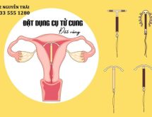 Đặt vòng tránh thai có hại cho sức khỏe không?