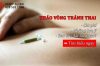 Tháo vòng tránh thai: Chi phí, lưu ý và bao lâu đặt lại được?