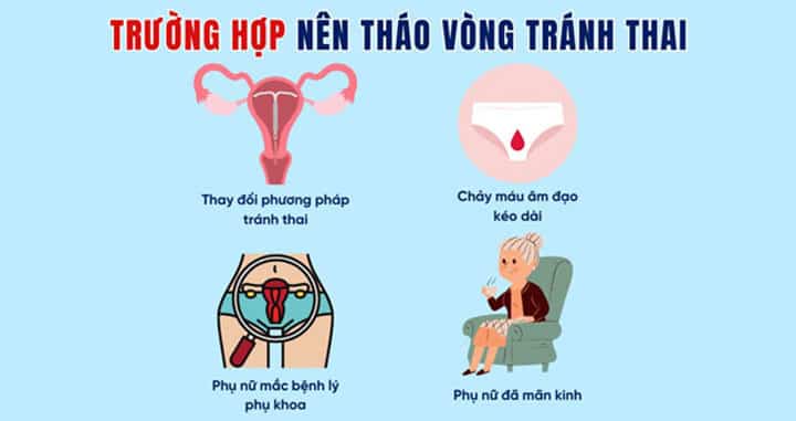 Chi phí tháo vòng tránh thai hết bao nhiêu tiền?