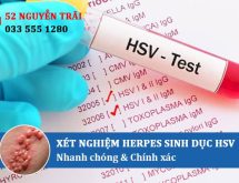Xét nghiệm Herpes sinh dục HSV nhanh chóng và chính xác