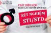 Xét nghiệm STI/STD giúp phát hiện sớm bệnh lây truyền tình dục