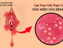 Âm đạo nổi mụn ngứa là dấu hiệu của bệnh gi?