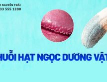 Cách chữa chuỗi hạt ngọc tại nhà và Hình ảnh chuỗi hạt ngọc dương vật
