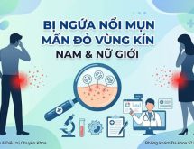 Tình Trạng Bị Ngứa Nổi Mụn Mẩn Đỏ Vùng Kín Ở Nam & Nữ Giới