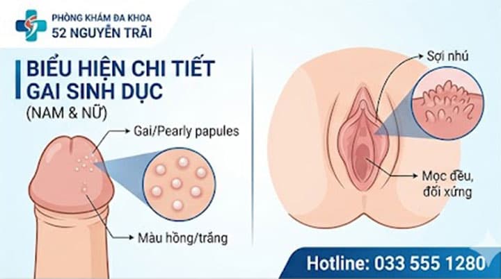BIỂU HIỆN CHI TIẾT CỦA GAI SINH DỤC Ở NAM GIỚI VÀ NỮ GIỚI