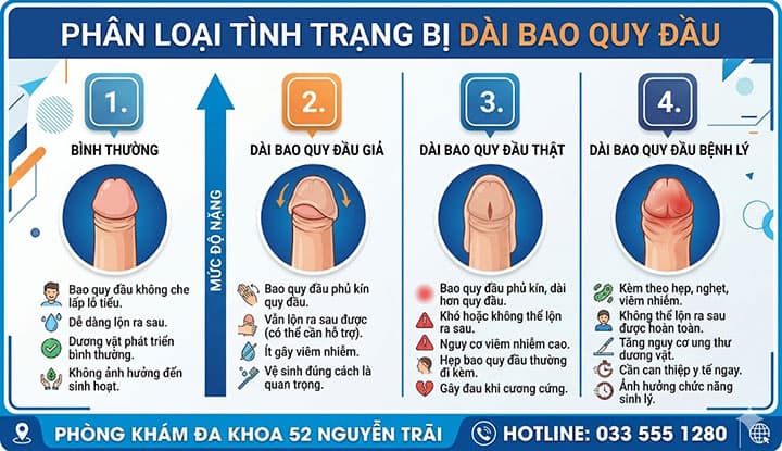 Phân Loại Tình Trạng Bị Dài Bao Quy Đầu