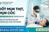 Đốt Mụn Thịt Mụn Cóc Ở Đâu Tốt Hà Nội? Địa Chỉ Điều Trị Dứt Điểm, Không Để Lại Sẹo