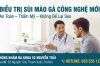 ĐỐT SÙI MÀO GÀ: TÌM HIỂU PHƯƠNG PHÁP, QUY TRÌNH, CHI PHÍ VÀ ĐỊA CHỈ UY TÍN TẠI HÀ NỘI