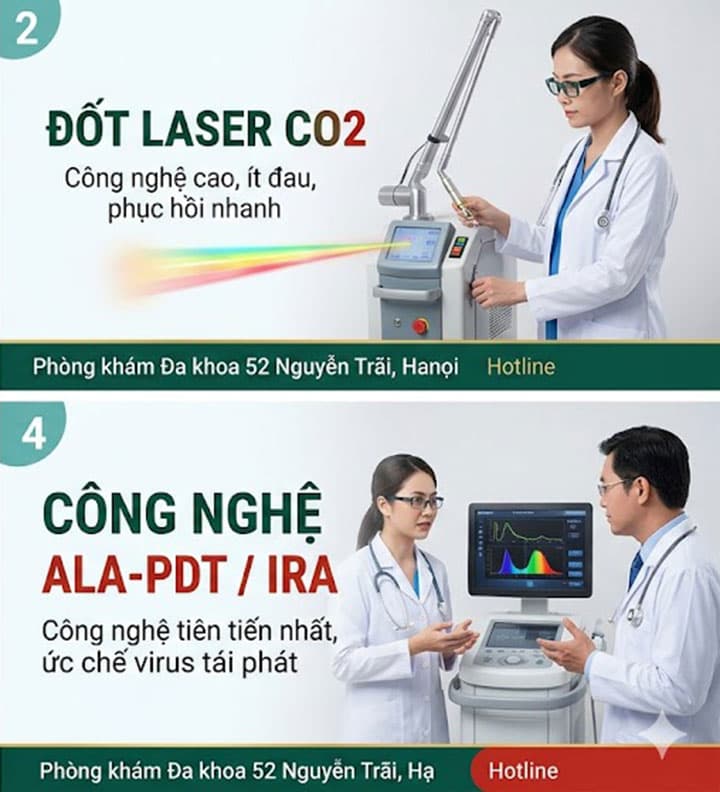 Các phương pháp đốt sùi mào gà phổ biến nhất hiện nay