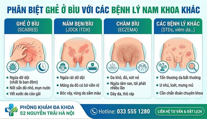 Phân Biệt Ghẻ Ở Bìu Với Các Bệnh Lý Nam Khoa Khác