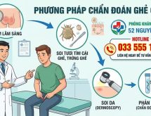 Bệnh Ghẻ Ở Bìu: Nguyên Nhân, Triệu Chứng Và Phương Pháp Điều Trị Hiệu Quả Toàn Diện