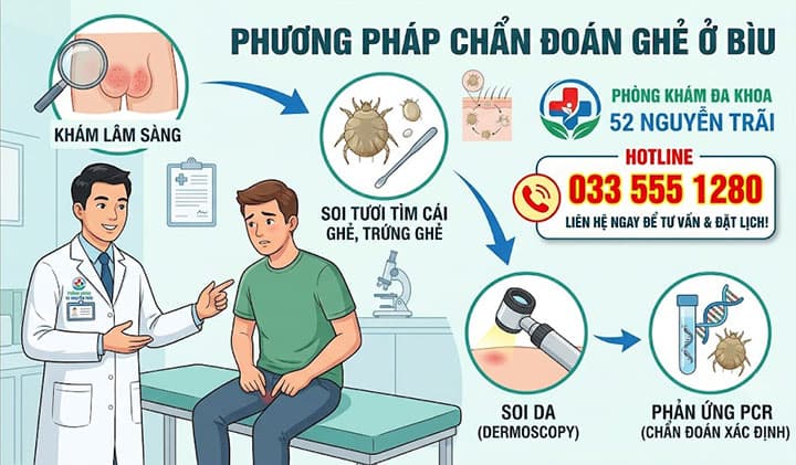 Phương Pháp Chẩn Đoán Ghẻ Ở Bìu Tại Cơ Sở Y Tế