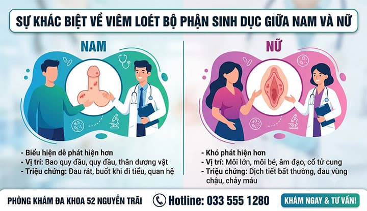 Sự Khác Biệt Về Viêm Loét Bộ Phận Sinh Dục Giữa Nam Và Nữ
