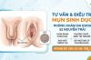 Mụn Sinh Dục Ở Nam Và Nữ Giới: Dấu Hiệu, Nguyên Nhân Và Phương Pháp Hỗ Trợ Điều Trị An Toàn, Hiệu Quả